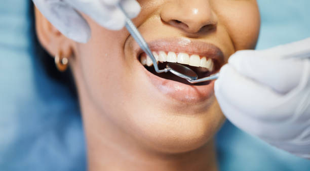 Best Emergency Dental Care for Broken or Chipped Teeth in Mdleton, ID